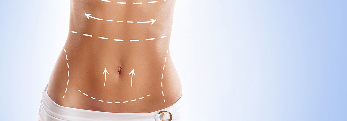 Body Contouring Surgeries